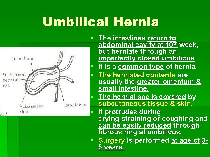 Umbilical Hernia § The intestines return to abdominal cavity at 10 th week, but