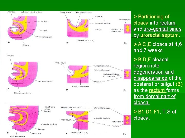 ØPartitioning of cloaca into rectum and uro-genital sinus by urorectal septum. ØA, C, E