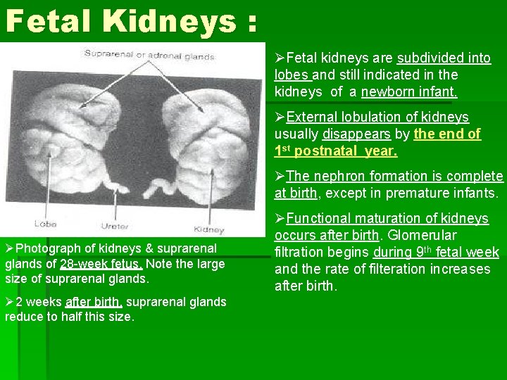 Fetal Kidneys : ØFetal kidneys are subdivided into lobes and still indicated in the