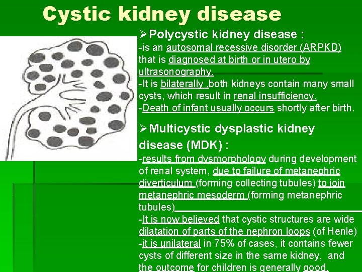 Cystic kidney disease ØPolycystic kidney disease : -is an autosomal recessive disorder (ARPKD) that