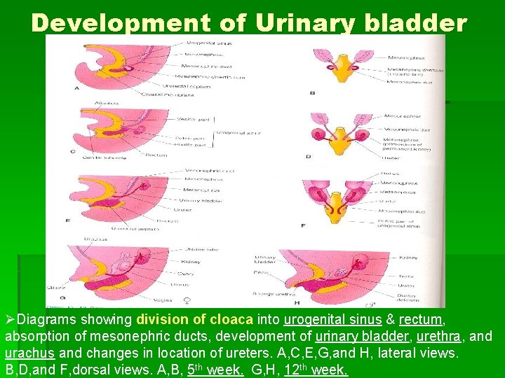 Development of Urinary bladder ØDiagrams showing division of cloaca into urogenital sinus & rectum,