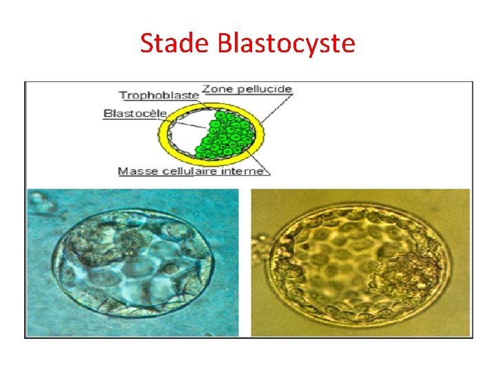 Stade Blastocyste 