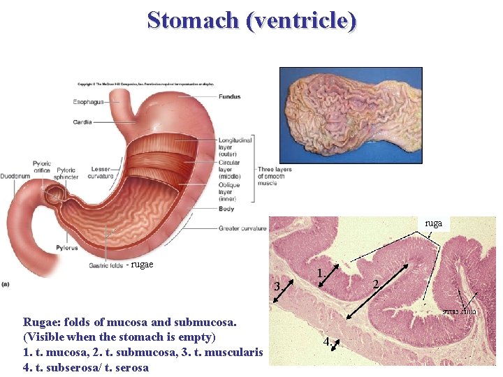 Stomach (ventricle) ruga - rugae 3. Rugae: folds of mucosa and submucosa. (Visible when