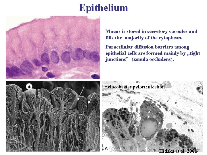 Epithelium Mucus is stored in secretory vacoules and fills the majority of the cytoplasm.