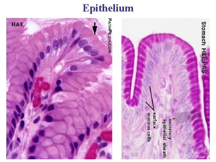 Epithelium H&E 