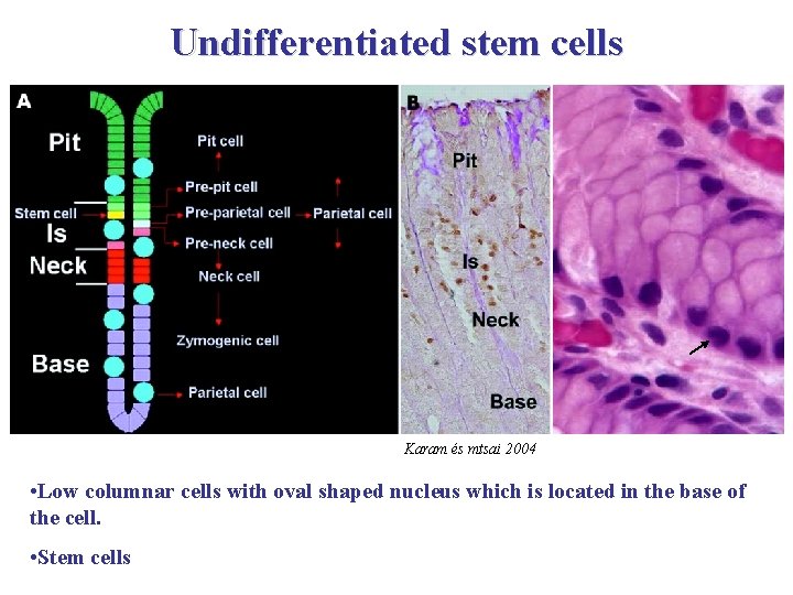Undifferentiated stem cells Karam és mtsai 2004 • Low columnar cells with oval shaped