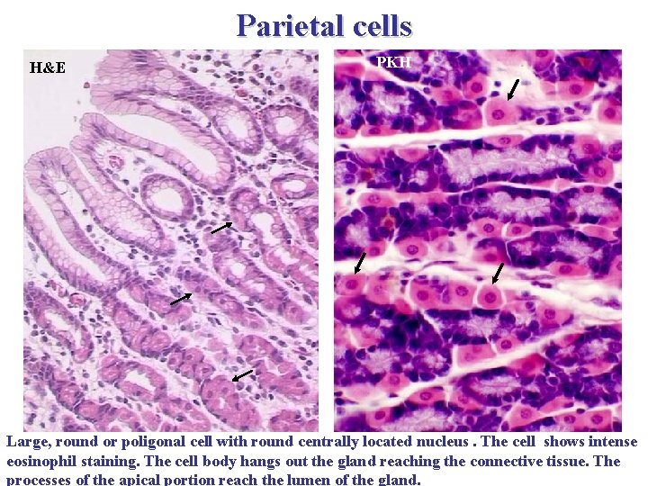 Parietal cells H&E PKH Large, round or poligonal cell with round centrally located nucleus.
