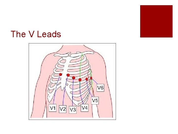 The V Leads 