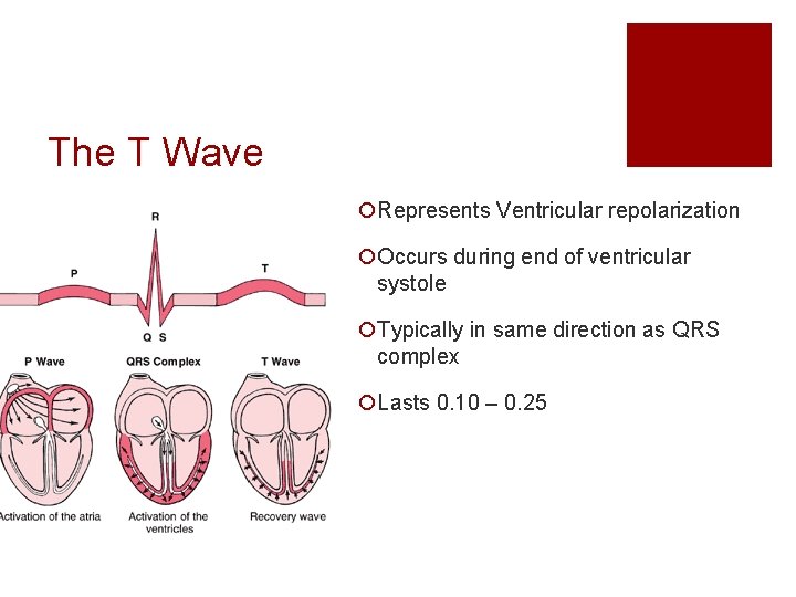 The T Wave ¡Represents Ventricular repolarization ¡Occurs during end of ventricular systole ¡Typically in