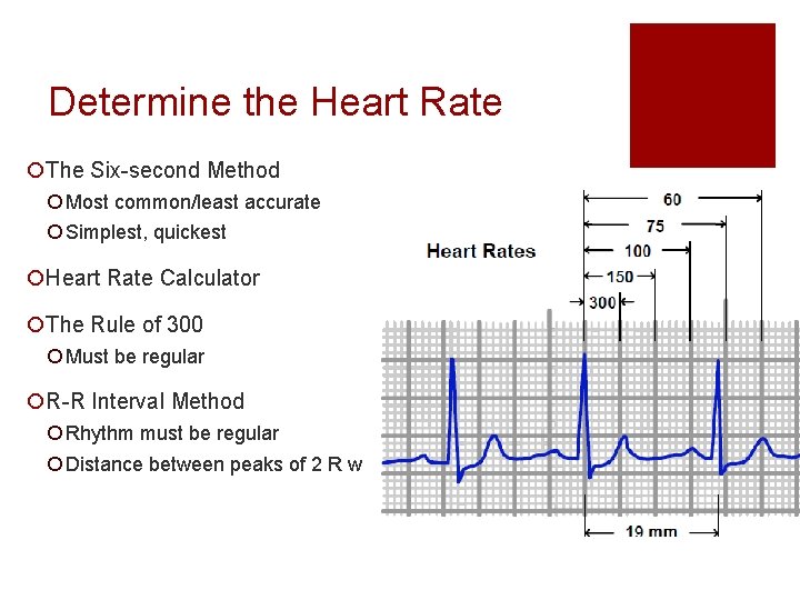 Determine the Heart Rate ¡The Six-second Method ¡ Most common/least accurate ¡ Simplest, quickest