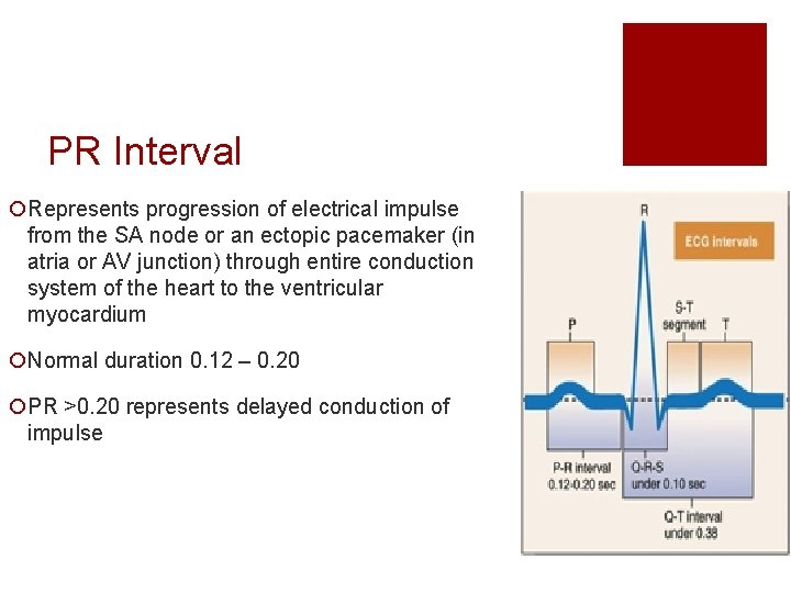 PR Interval ¡Represents progression of electrical impulse from the SA node or an ectopic