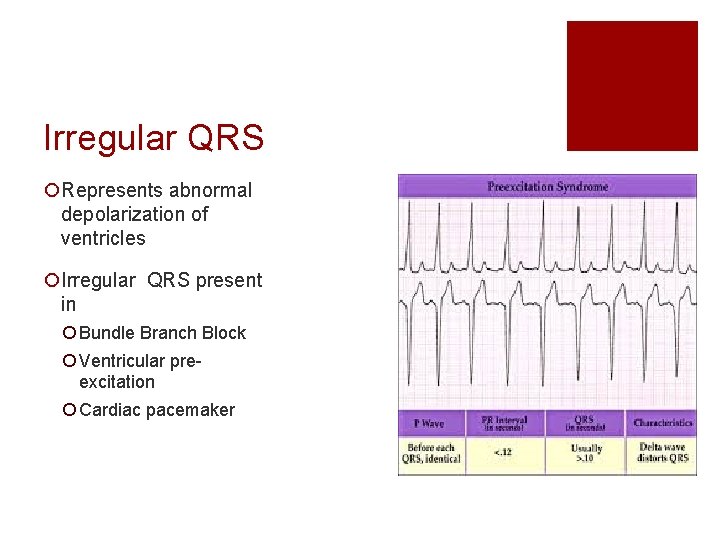 Irregular QRS ¡Represents abnormal depolarization of ventricles ¡Irregular QRS present in ¡ Bundle Branch
