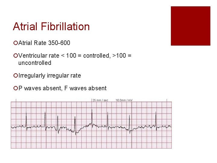 Atrial Fibrillation ¡Atrial Rate 350 -600 ¡Ventricular rate < 100 = controlled, >100 =