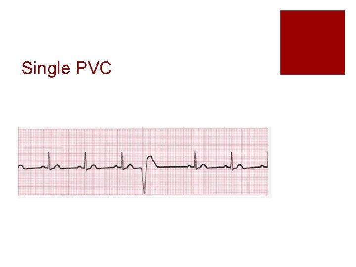 Single PVC 