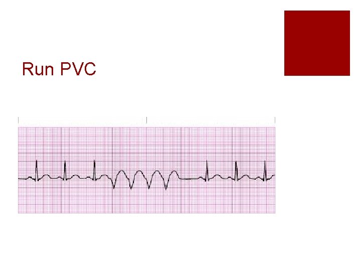 Run PVC 