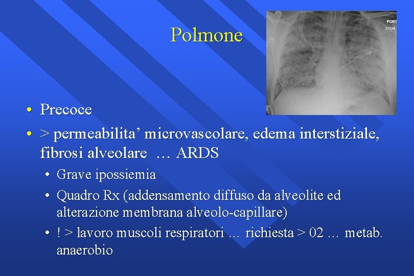 Polmone • Precoce • > permeabilita’ microvascolare, edema interstiziale, fibrosi alveolare … ARDS •