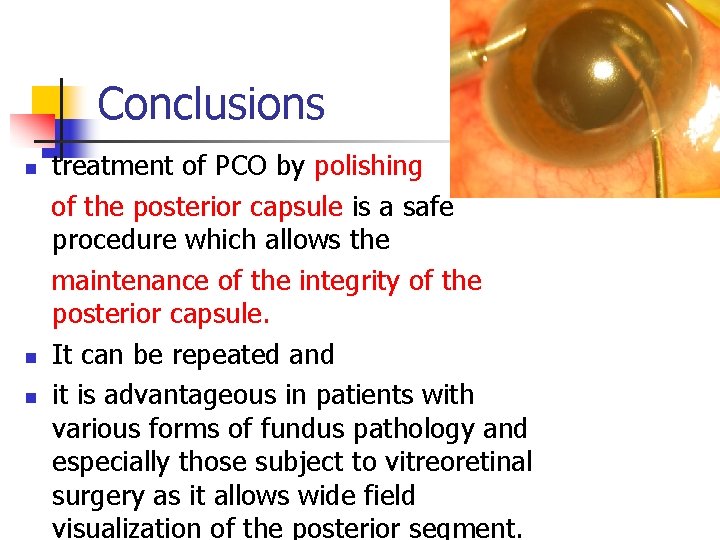 Conclusions n n n treatment of PCO by polishing of the posterior capsule is