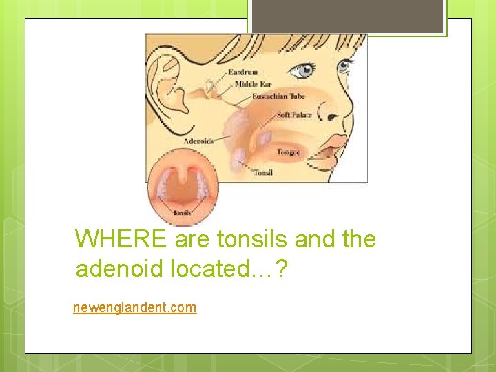 WHERE are tonsils and the adenoid located…? newenglandent. com 
