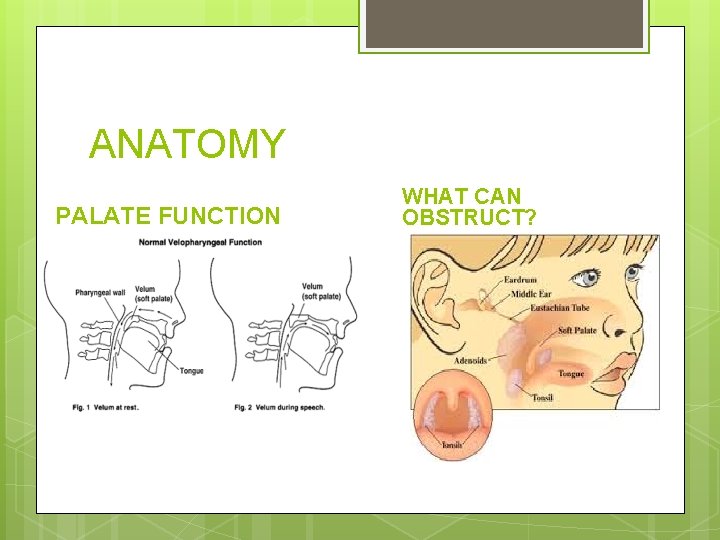 ANATOMY PALATE FUNCTION WHAT CAN OBSTRUCT? 