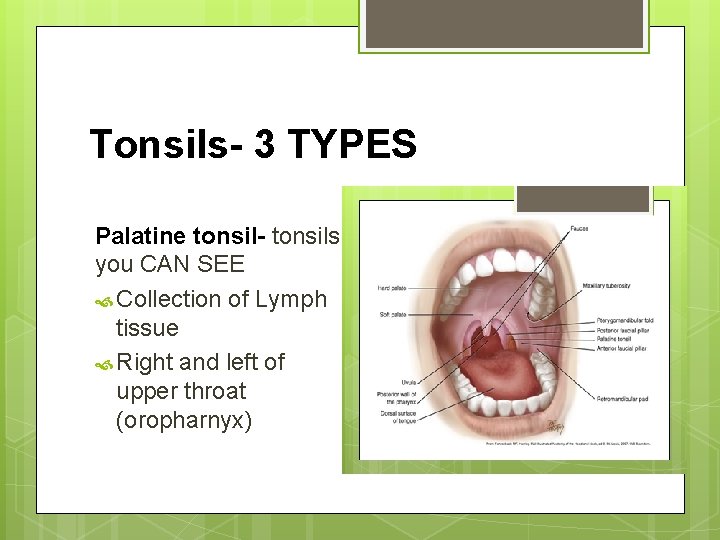 Tonsils- 3 TYPES Palatine tonsil- tonsils you CAN SEE Collection of Lymph tissue Right