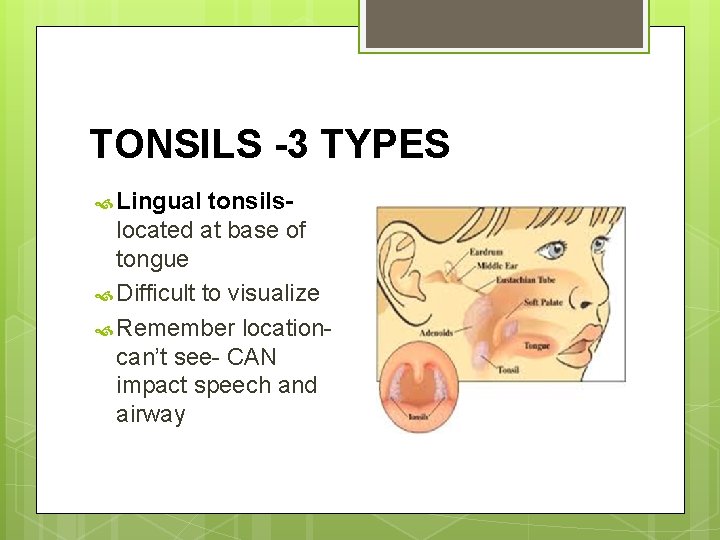 TONSILS -3 TYPES Lingual tonsilslocated at base of tongue Difficult to visualize Remember locationcan’t