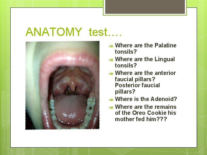 ANATOMY test…. Where are the Palatine tonsils? Where are the Lingual tonsils? Where are