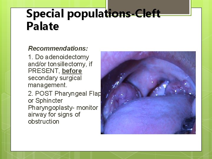 Special populations-Cleft Palate Recommendations: 1. Do adenoidectomy and/or tonsillectomy, if PRESENT, before secondary surgical