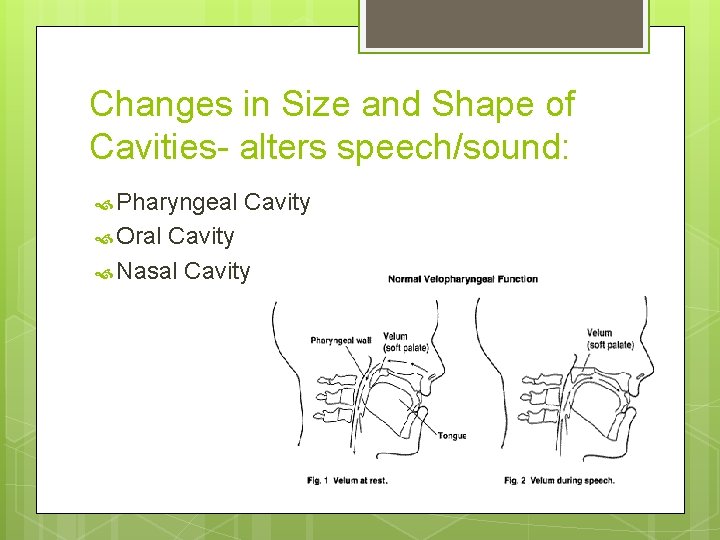Changes in Size and Shape of Cavities- alters speech/sound: Pharyngeal Oral Cavity Nasal Cavity