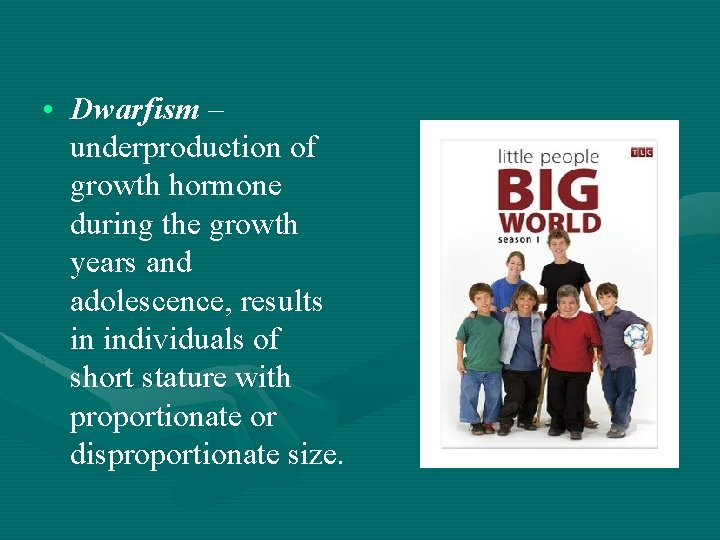  • Dwarfism – underproduction of growth hormone during the growth years and adolescence,