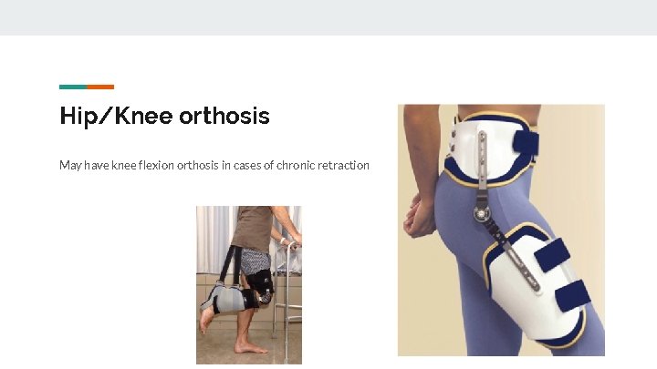 Hip/Knee orthosis May have knee flexion orthosis in cases of chronic retraction 