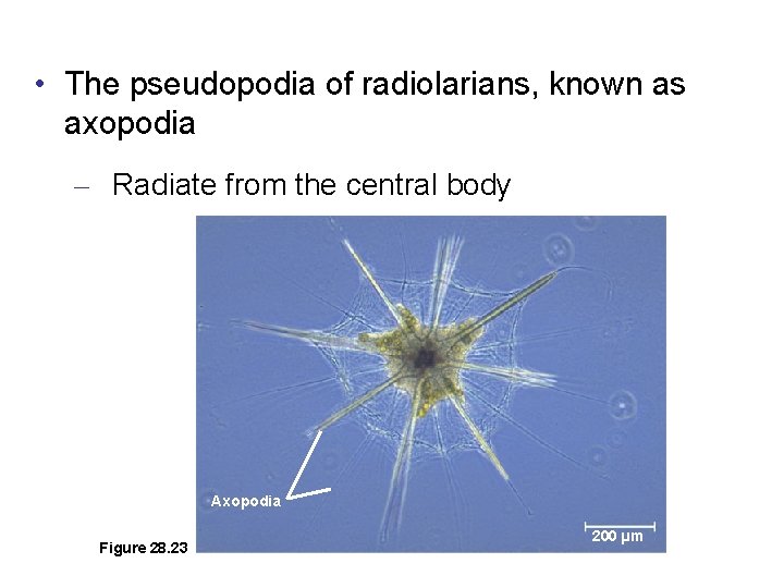 • The pseudopodia of radiolarians, known as axopodia – Radiate from the central