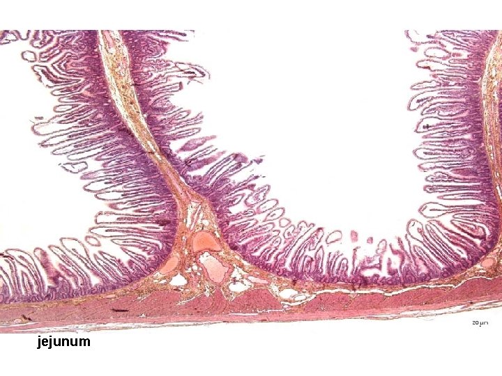 jejunum 