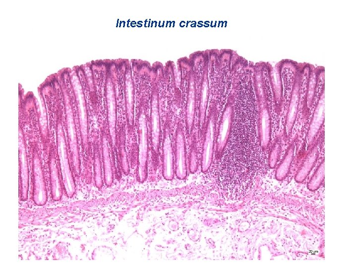 Intestinum crassum 