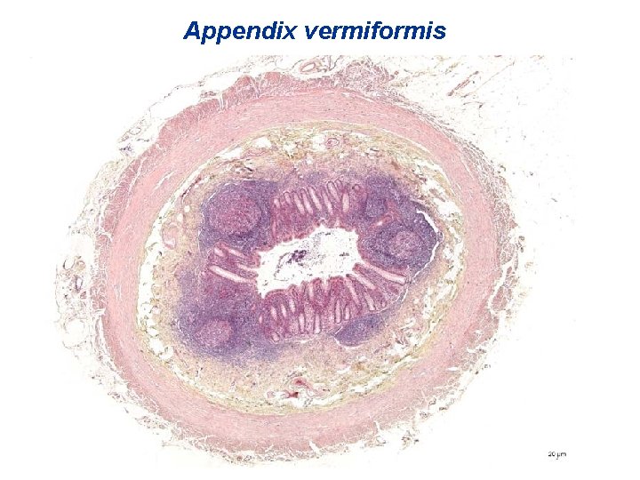 Appendix vermiformis 