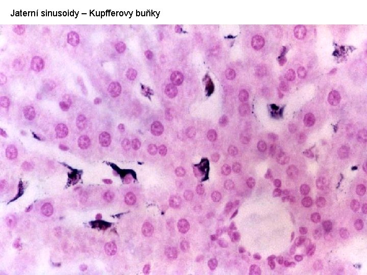 Jaterní sinusoidy – Kupfferovy buňky 