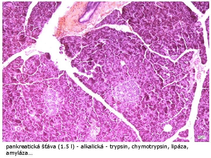 pankreatická šťáva (1. 5 l) - alkalická - trypsin, chymotrypsin, lipáza, amyláza… 