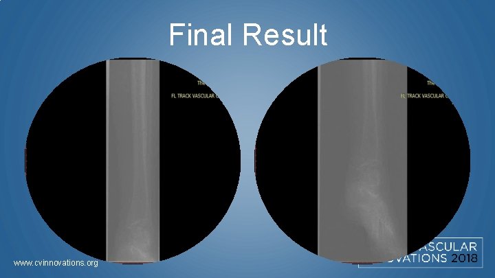 Final Result www. cvinnovations. org 