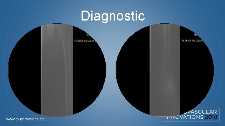 Diagnostic www. cvinnovations. org 