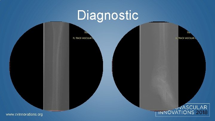 Diagnostic www. cvinnovations. org 