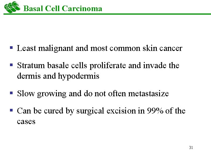 Basal Cell Carcinoma § Least malignant and most common skin cancer § Stratum basale