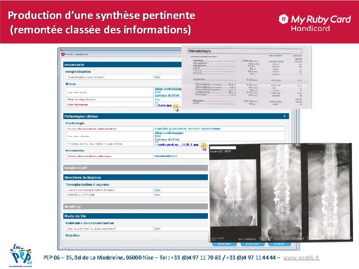 Production d’une synthèse pertinente (remontée classée des informations) PEP 06 – 35, Bd de