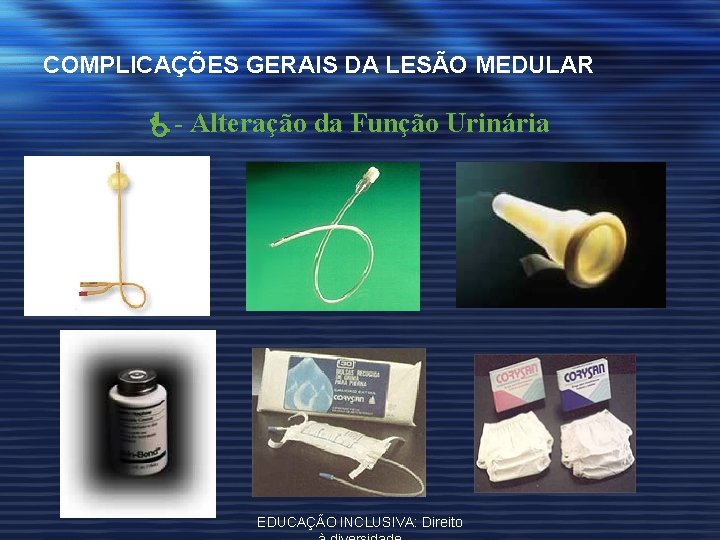 COMPLICAÇÕES GERAIS DA LESÃO MEDULAR - Alteração da Função Urinária EDUCAÇÃO INCLUSIVA: Direito 