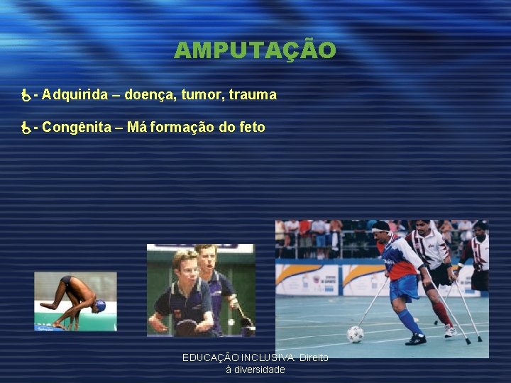 AMPUTAÇÃO - Adquirida – doença, tumor, trauma - Congênita – Má formação do feto