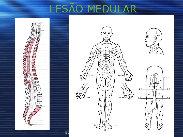 LESÃO MEDULAR EDUCAÇÃO INCLUSIVA: Direito 