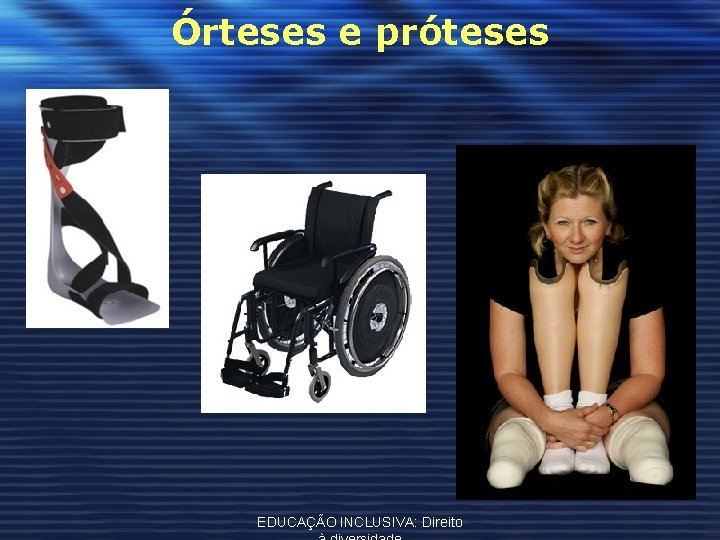 Órteses e próteses EDUCAÇÃO INCLUSIVA: Direito 