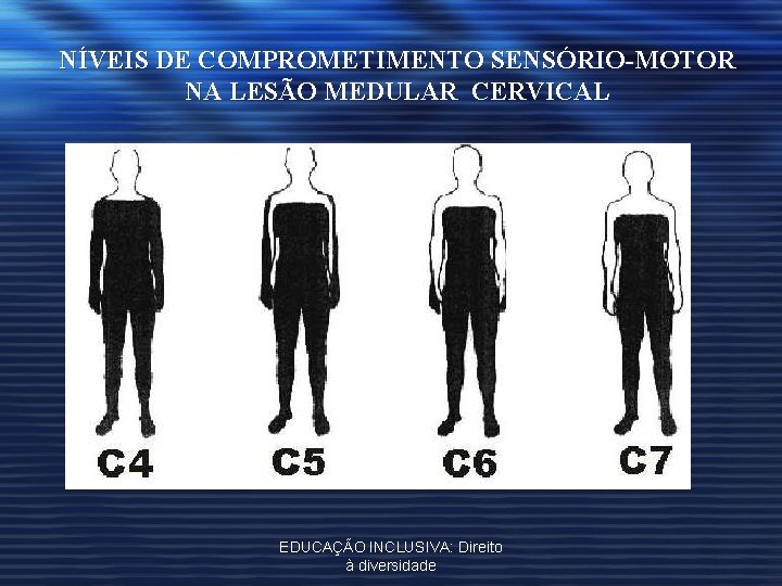 NÍVEIS DE COMPROMETIMENTO SENSÓRIO-MOTOR NA LESÃO MEDULAR CERVICAL EDUCAÇÃO INCLUSIVA: Direito à diversidade 