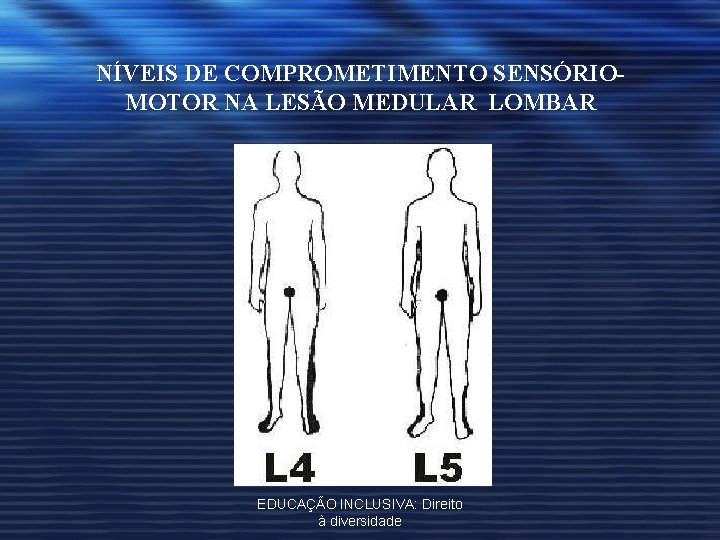 NÍVEIS DE COMPROMETIMENTO SENSÓRIOMOTOR NA LESÃO MEDULAR LOMBAR EDUCAÇÃO INCLUSIVA: Direito à diversidade 