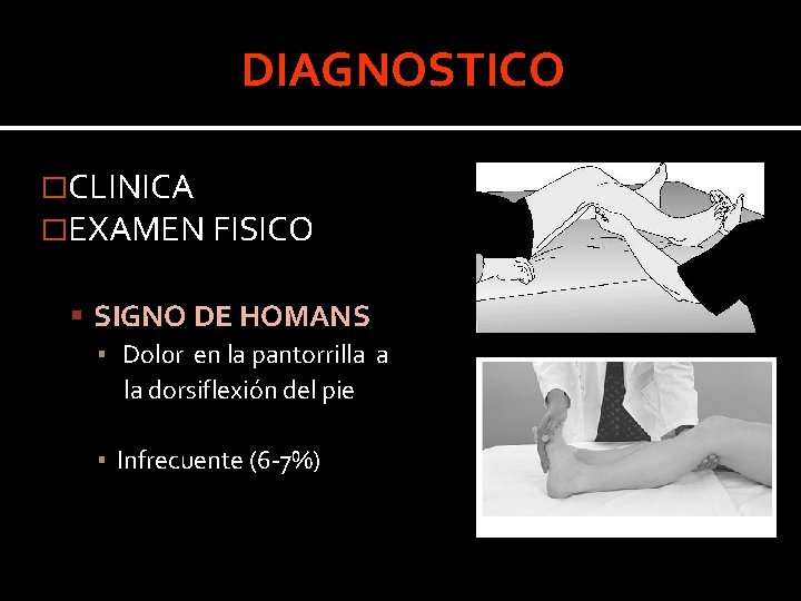 DIAGNOSTICO �CLINICA �EXAMEN FISICO SIGNO DE HOMANS ▪ Dol 0 r en la pantorrilla DIAGNOSTICO �CLINICA �EXAMEN FISICO SIGNO DE HOMANS ▪ Dol 0 r en la pantorrilla