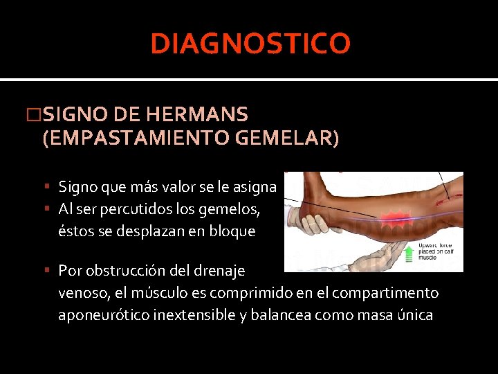 DIAGNOSTICO �SIGNO DE HERMANS (EMPASTAMIENTO GEMELAR) Signo que más valor se le asigna Al DIAGNOSTICO �SIGNO DE HERMANS (EMPASTAMIENTO GEMELAR) Signo que más valor se le asigna Al