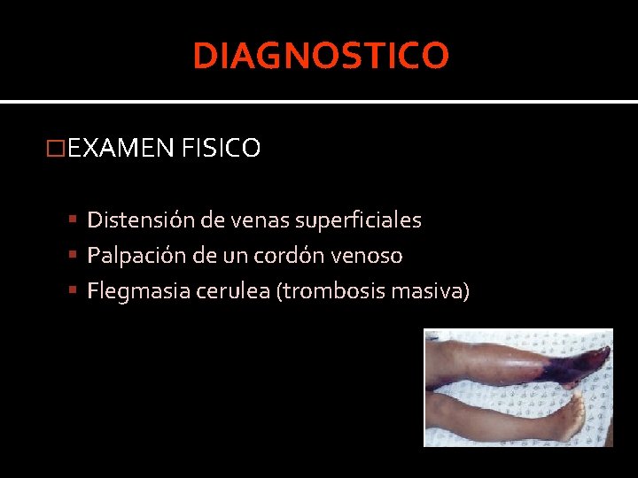 DIAGNOSTICO �EXAMEN FISICO Distensión de venas superficiales Palpación de un cordón venoso Flegmasia cerulea DIAGNOSTICO �EXAMEN FISICO Distensión de venas superficiales Palpación de un cordón venoso Flegmasia cerulea